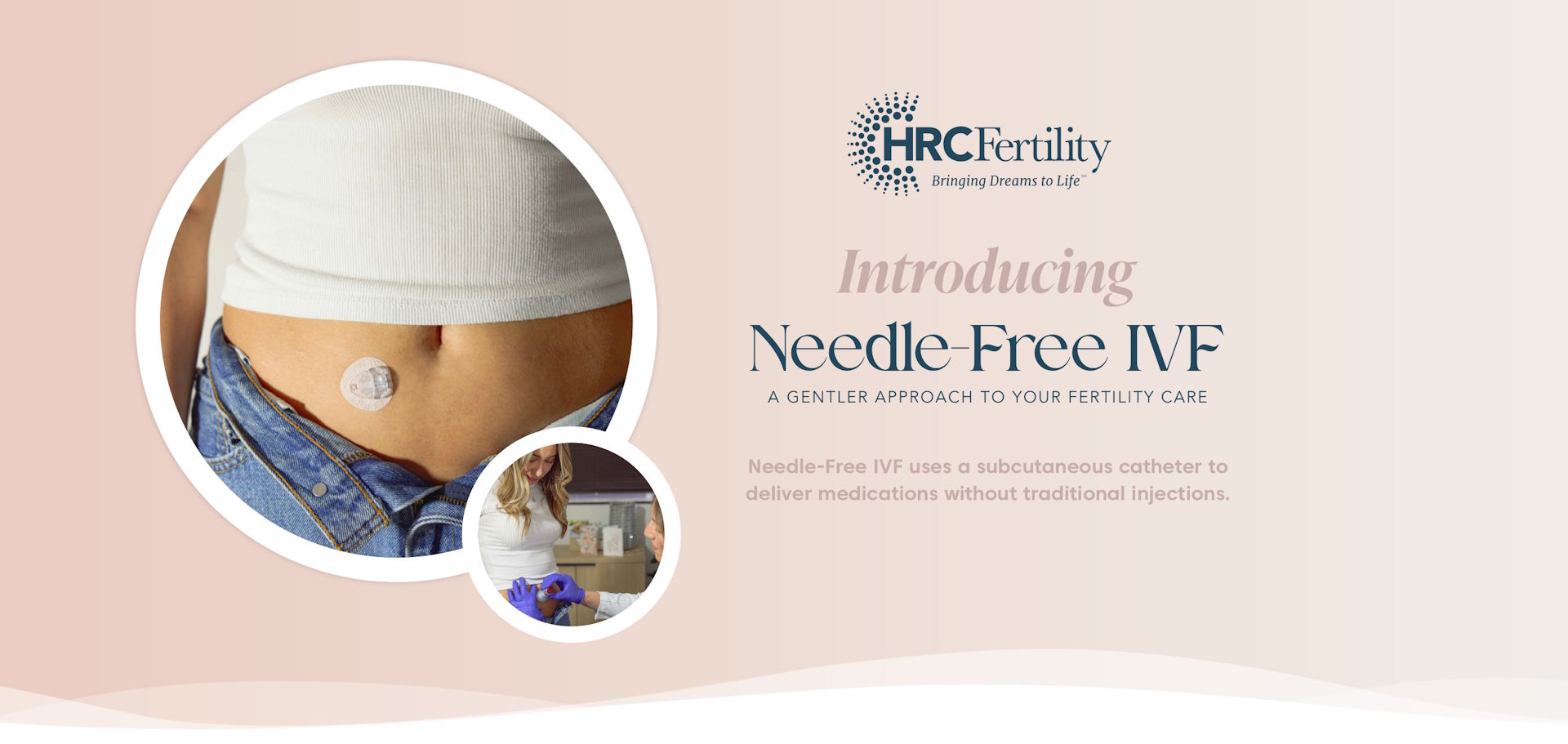 Needle-Free IVF at HRC Fertility