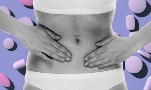 Dr. Llarena discusses endometriosis.