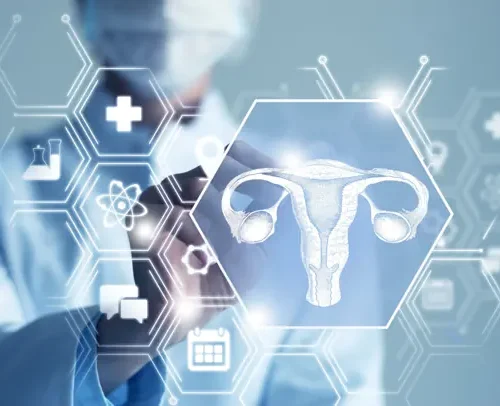 Dr. Coffler in article discussing PCOS
